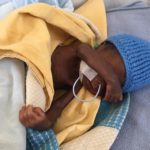 The coronavirus emergency accelerates malnutrition, 1 in 2 children is at risk